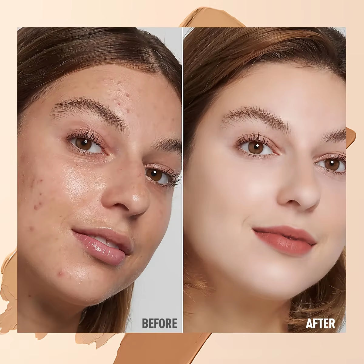 Ultimate Waterproof Concealer Palette for Acne Marks & Dark Circles - Long Lasting & Moisturizing Face Makeup