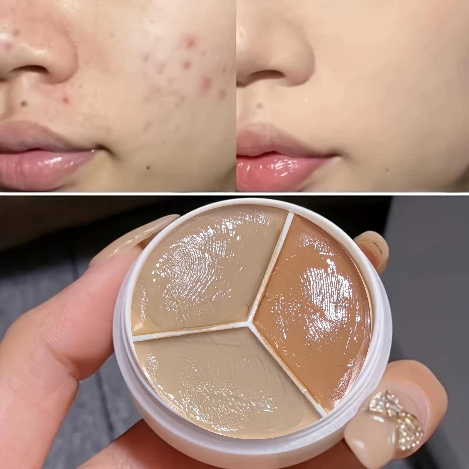 Ultimate Waterproof Concealer Palette for Acne Marks & Dark Circles - Long Lasting & Moisturizing Face Makeup